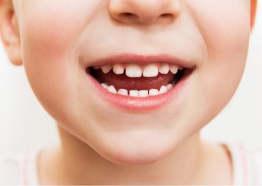 How Can Thumb Sucking and Pacifier Use Affect My Child’s Teeth
