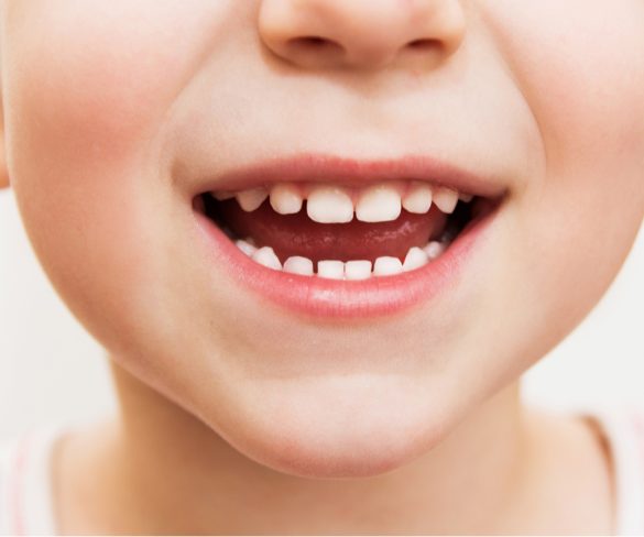 How Can Thumb Sucking and Pacifier Use Affect My Child’s Teeth